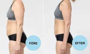 Före och efter-bild på en kvinna som visar en tydlig kroppsförändring. Möjligt att gå ner 0,5 kg i veckan med rätt metod.