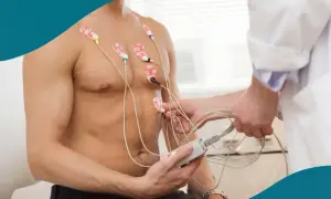 Man får EKG-elektroder fästa på bröstet för att mäta hjärtats hård puls.