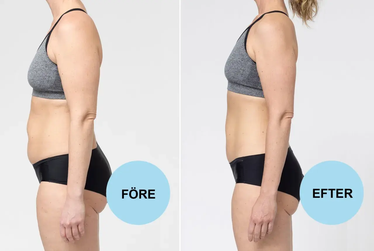 Före och efter-bilder visar en kvinna som lyckats gå ner 10 kg på 2 veckor.