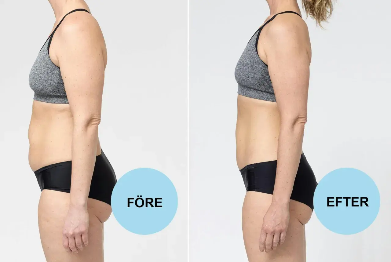 Före och efter-bild på en kvinna som visar en tydlig kroppsförändring. Möjligt att gå ner 0,5 kg i veckan med rätt metod.